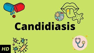 CANDIDIASIS Causes Signs and Symptoms Diagnosis and Treatment [upl. by Locke]