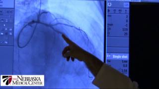 Percutaneous coronary Intervention stenting [upl. by Zimmermann628]