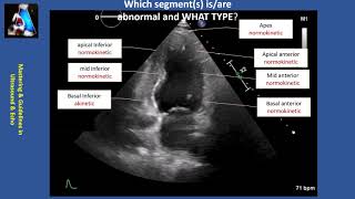 Hemodynamics  Circulatory System Physiology [upl. by Aibar267]