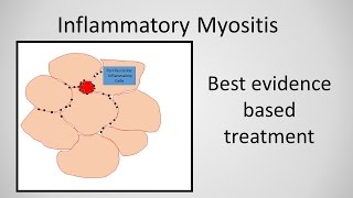 Myositis Inflammatory Myopathy Treatment [upl. by Kcirreg289]