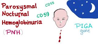 Paroxysmal Nocturnal Hemoglobinuria PNH  Hemolytic Anemia  Complement Alternative Pathway [upl. by Viafore808]