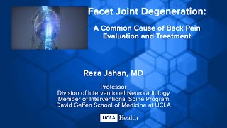 Facet Joint Degeneration A Common Cause of Back Pain Evaluation and Treatment [upl. by Alaet]