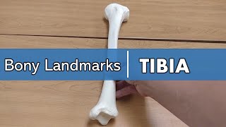 bony landmarks of the tibia [upl. by Hayward]