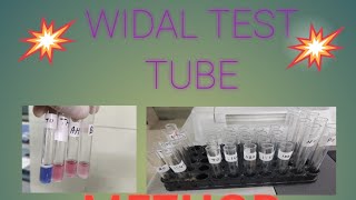 WIDAL TEST TUBE METHOD [upl. by Nylirac883]