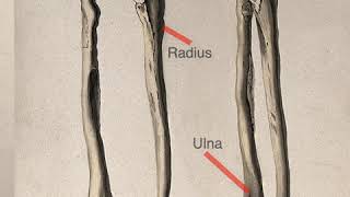 One Minute Anatomy A Difference Between the TibiaFibula amp RadiusUlna [upl. by Garth294]