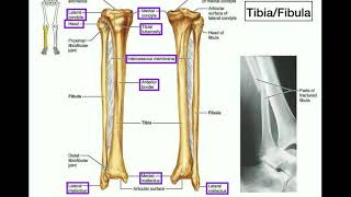 Anatomy  Specific Parts of the Tibia amp Fibula  Left vs Right [upl. by Anahcar453]