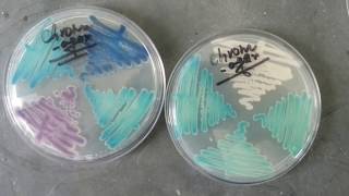 chromagar detection of various Candida spp [upl. by Enillebyam378]