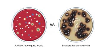 RAPIDChromogenic Media Solutions [upl. by Euqirat]