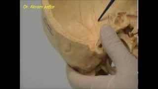 The Ventricles Neuroanatomy Video Lab  Brain Dissections [upl. by Mowbray]