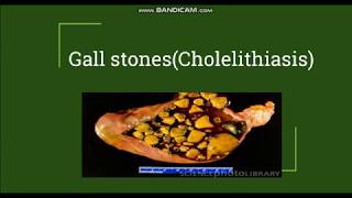 Cholelithiasis  Gallstones Pathogenesis amp Morphology [upl. by Friedlander488]