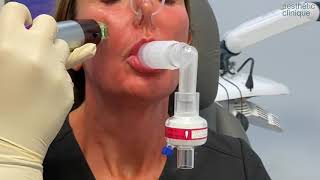 Hyperdilute Radiesse Neck Injections And RF Microneedling Dr Weiner’s triNECKta [upl. by Iggy]