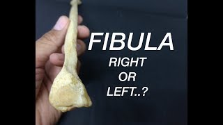 FIBULA  SIDE DETERMINATION [upl. by Turley]